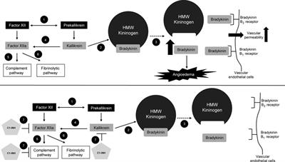 Treatment of hereditary angioedema—single or multiple pathways to the rescue